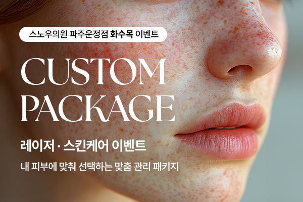 패키지