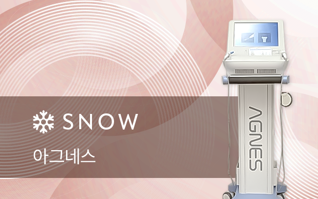 아그네스