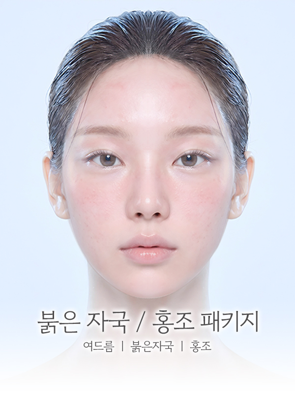붉은 자국 / 홍조 패키지