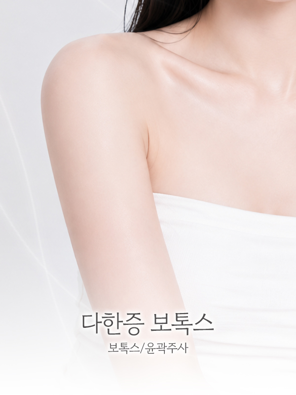 다한증 보톡스