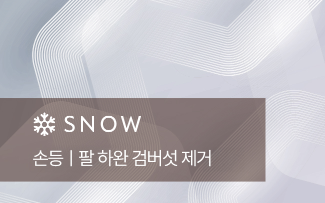 손등| 팔 하완 검버섯 제거
