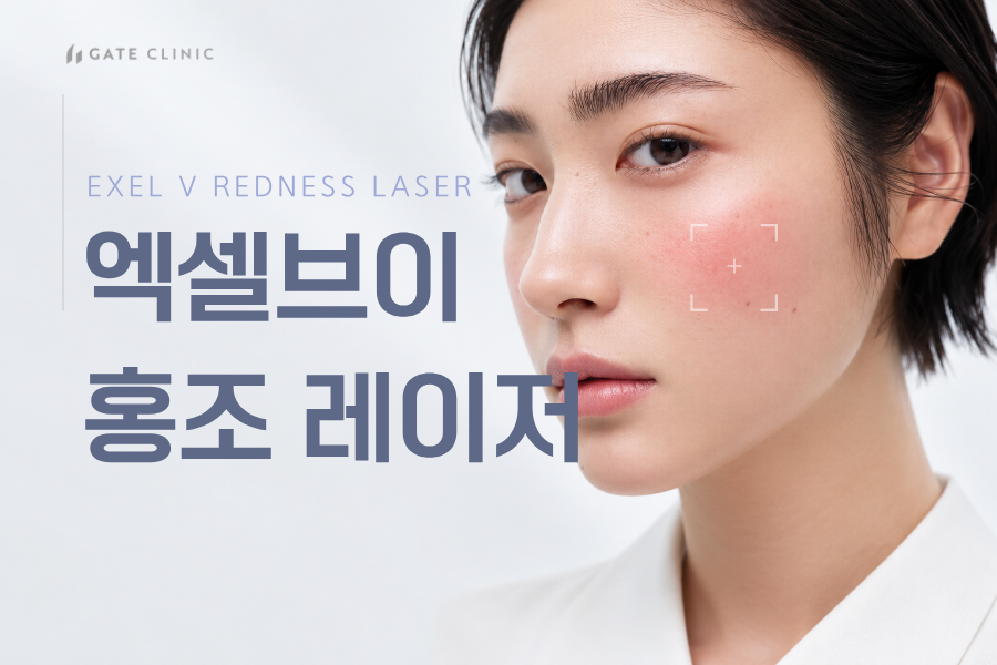 엑셀브이 홍조 레이저