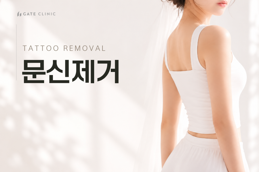 문신제거