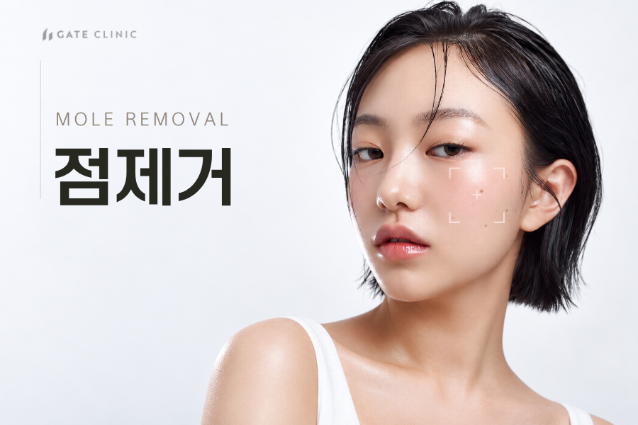 점제거