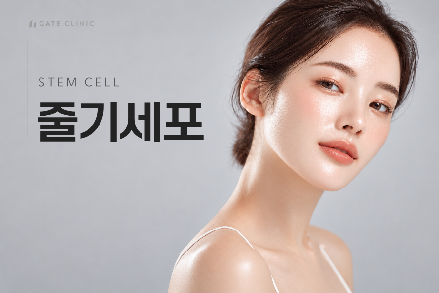 줄기세포