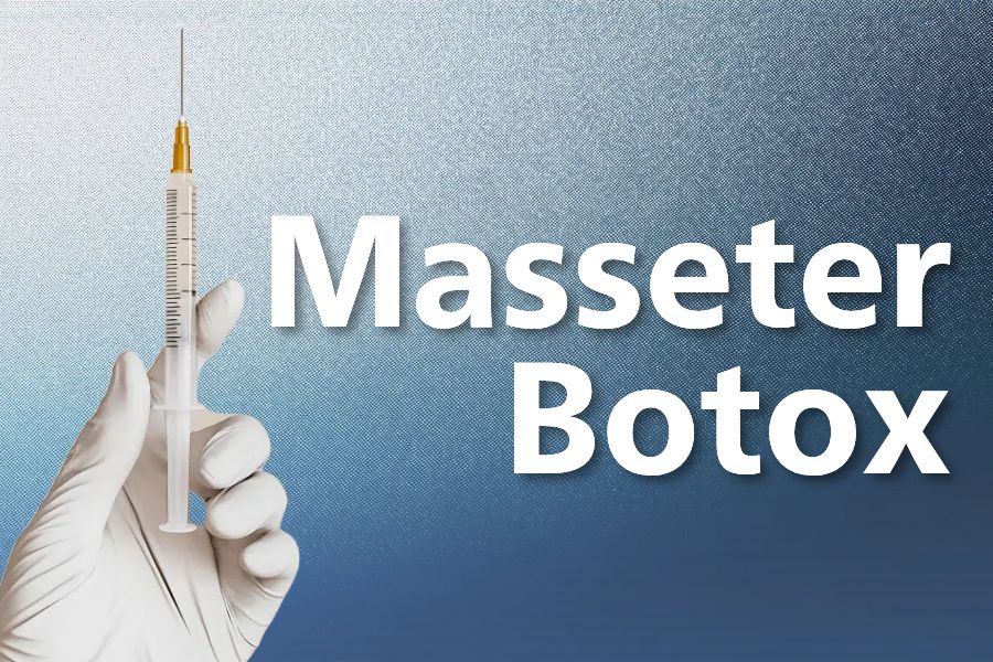 Masseter  Botox