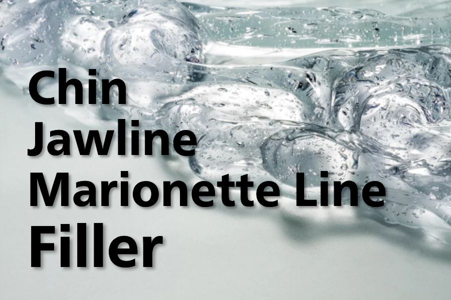 Chin/Marionette Line Filler