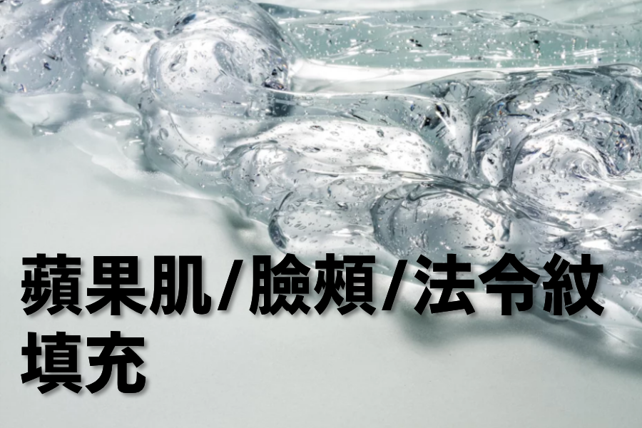 前颧骨/侧面颊/前面颊/法令纹玻尿酸