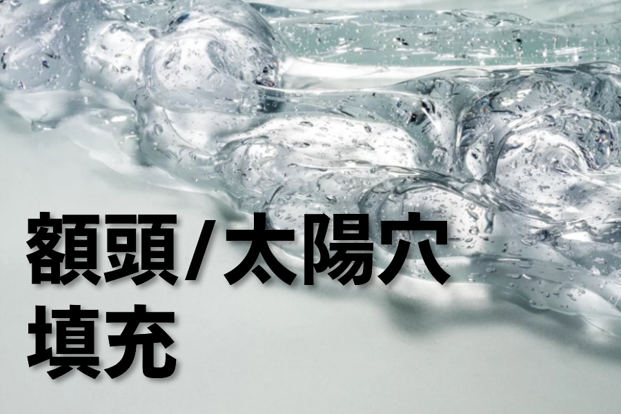 额头/太阳穴玻尿酸