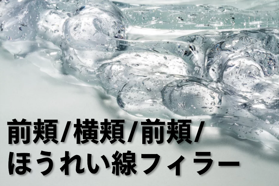 前頬/横頬/前頬/ほうれい線フィラー