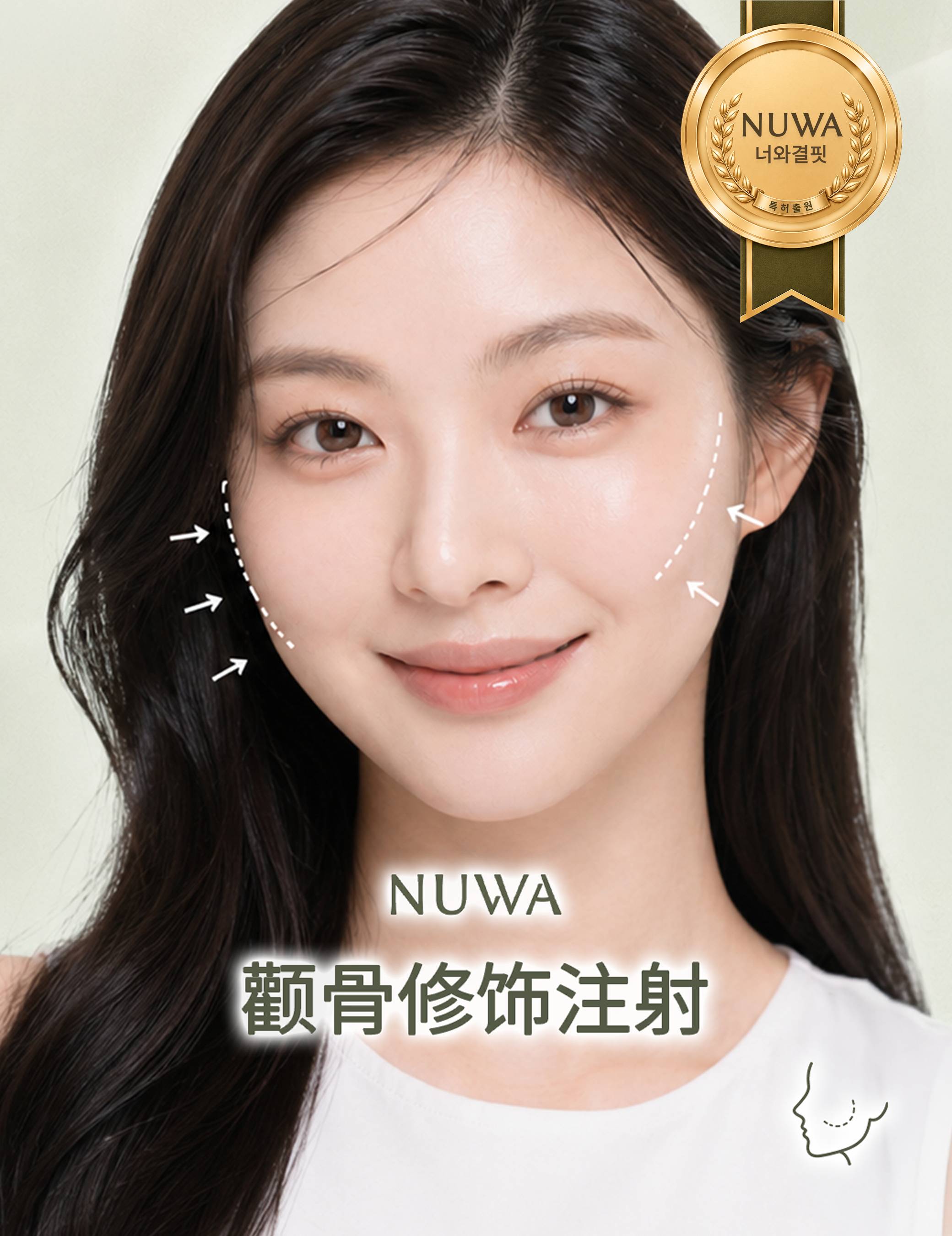 颧骨修饰注射